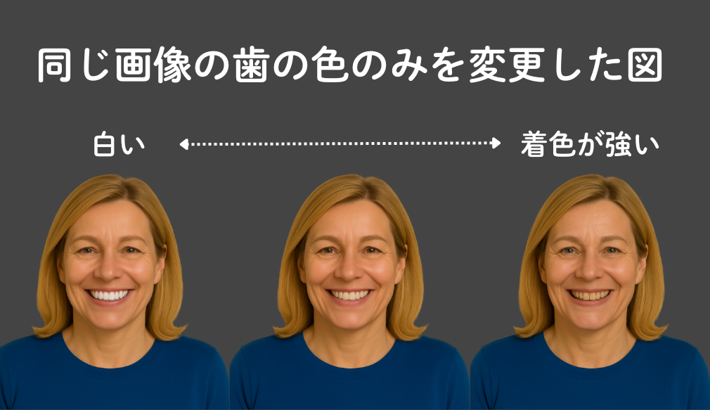岩国市　歯医者　歯の色
