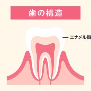 岩国市　歯医者　虫歯