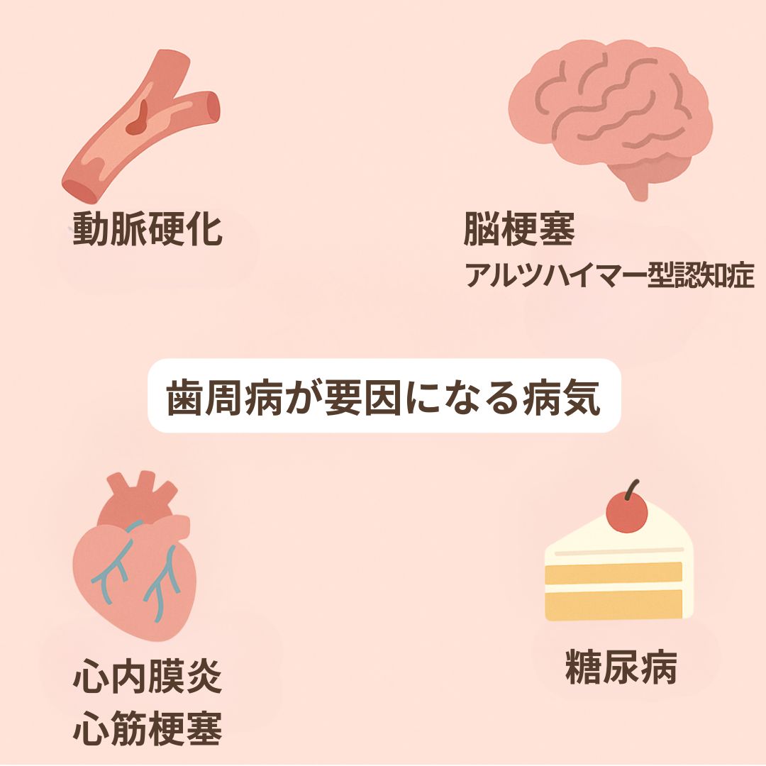 岩国市　歯周病