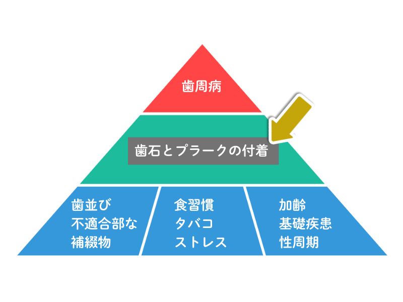 岩国市　歯周病