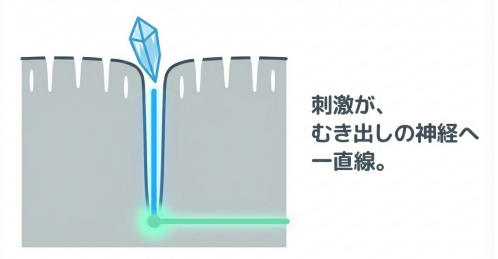 岩国市 歯科 知覚過敏