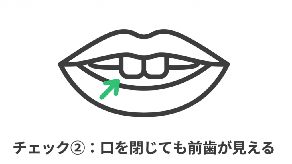 岩国市 矯正 出っ歯