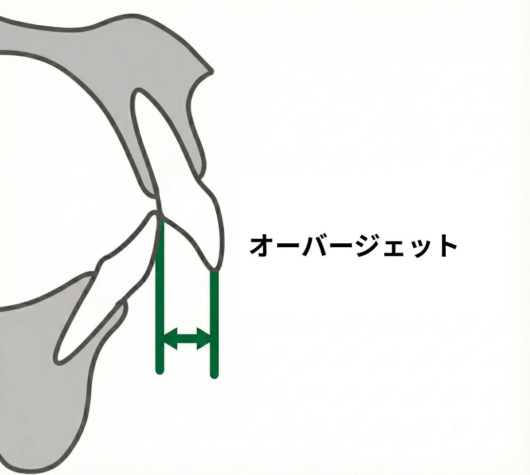 岩国市 矯正 出っ歯