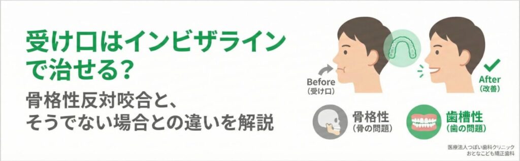 岩国市　矯正　受け口