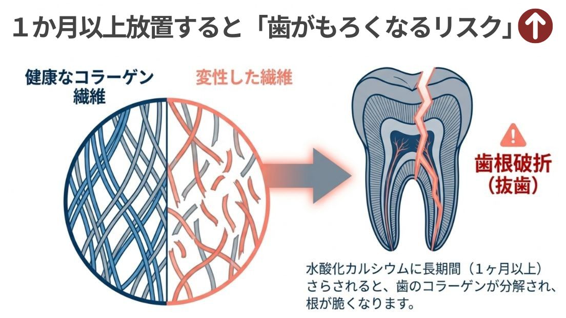 岩国市　歯科　精密根管治療
